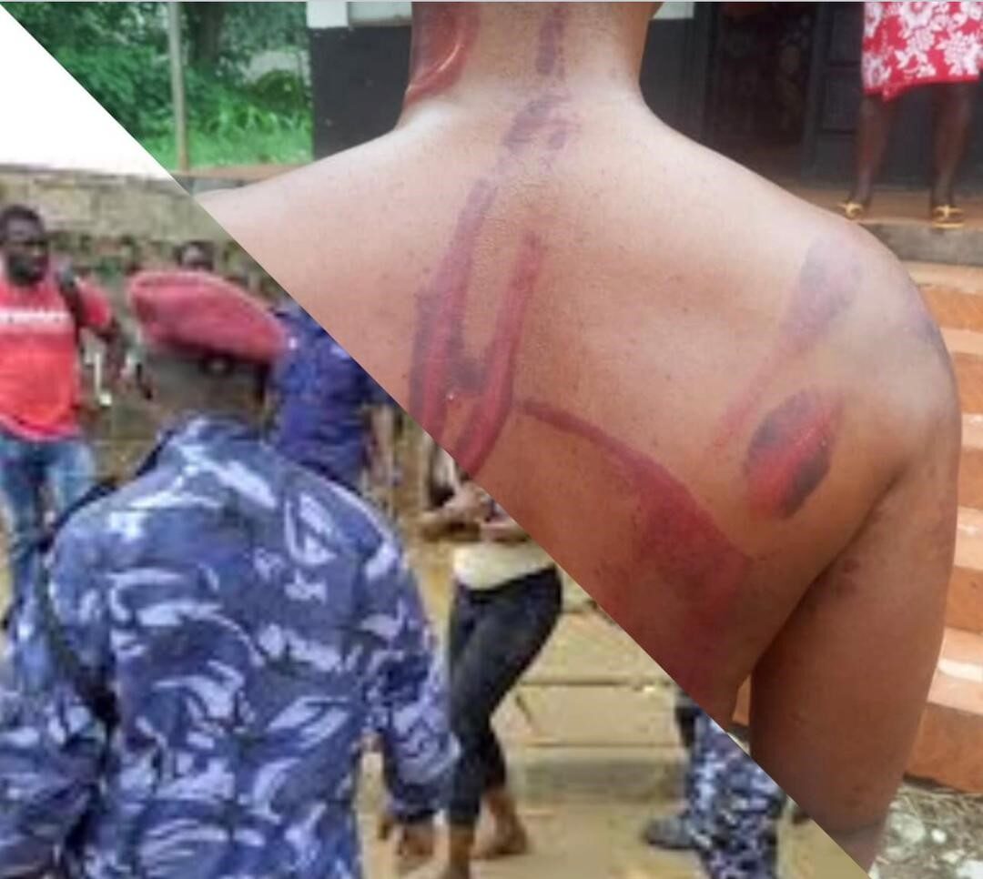 Read more about the article Alleged Police Brutality Sparks Outrage in Karene District