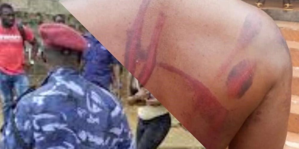 Alleged Police Brutality Sparks Outrage