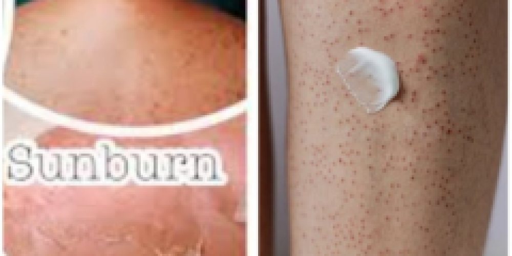 Exposing Skincare Myths - What You Might Be Doing Wrong and How to Fix It
